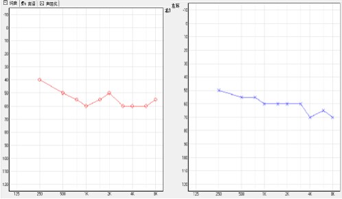 助听器选配听力检测图