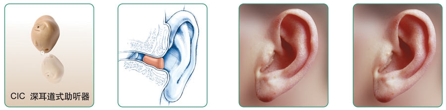 深耳道助听器