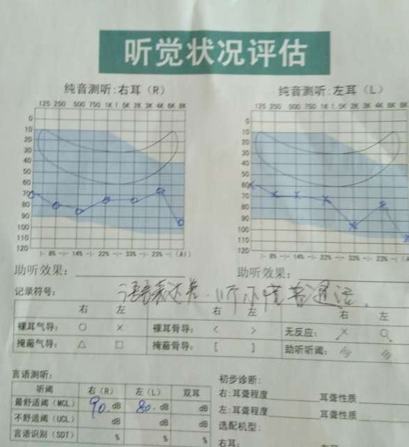 儿童听力检测报告